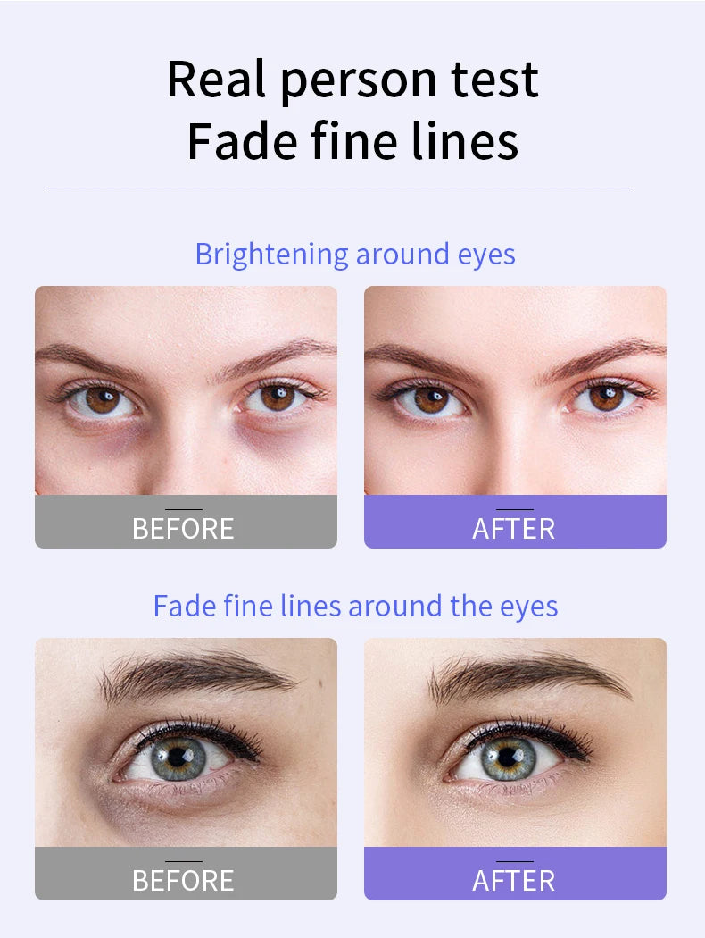 O'CHEAL Creme para Olhos com Esfera Roller – Anti-Idade & Anti-Olheiras